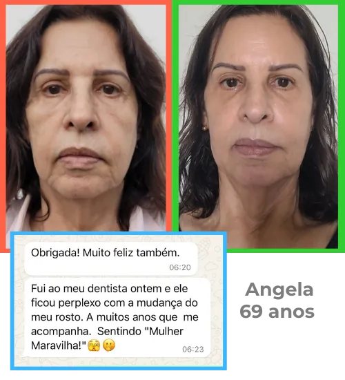 Angela, 69 anos – antes e depois