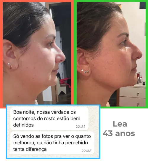 Lea, 43 anos – antes e depois