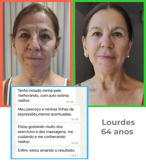 Lourdes, 64 anos – antes e depois